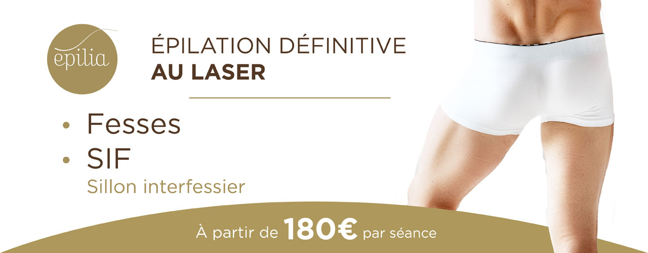 epilation-laser-femmes-sif-homme-mons