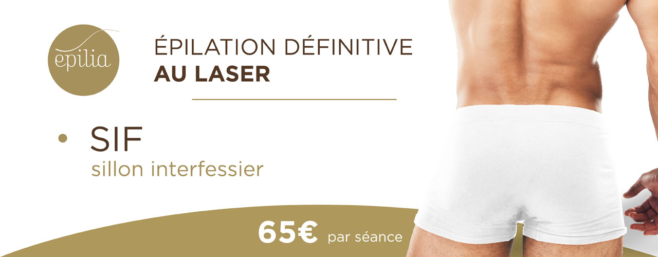 epilation-laser-sif-homme-mons