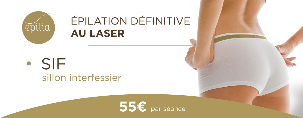 epilation-laser-sif-mons