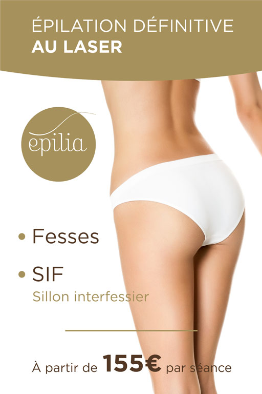 epilation-laser-fesses-sif-mons-mob